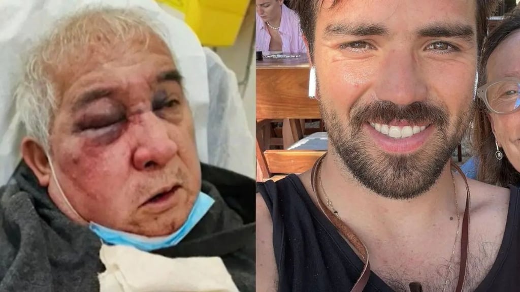 VIDEO. Brutal agresión en Vitacura: conserje recibe diagnóstico que cambia su vida para siempre