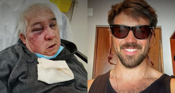 Tiene fracturas en el rostro y riesgo de perder un ojo: brutal golpiza a conserje en Vitacura