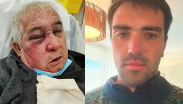 Conmoción en Vitacura: conserje agredido a puñetazos relata lo que ocurrió esa noche